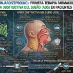 Tirzepatida Aprobada para Apnea Obstructiva del Sueño